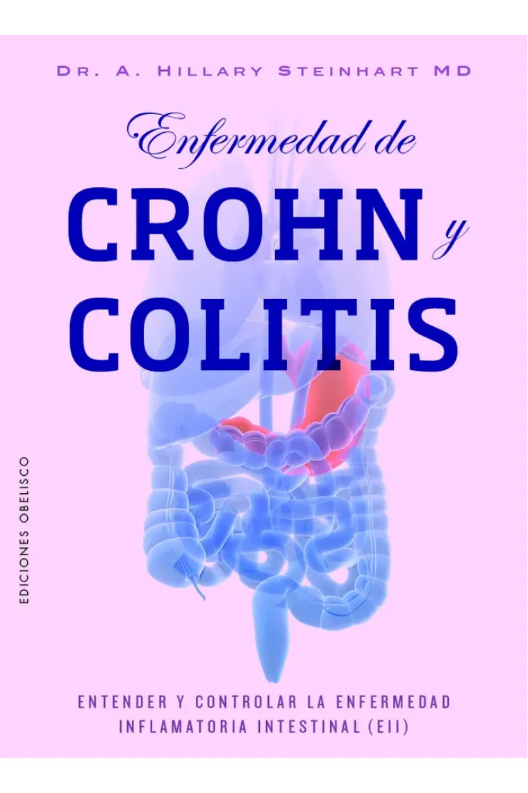 Enfermedad de Crohn y colitis