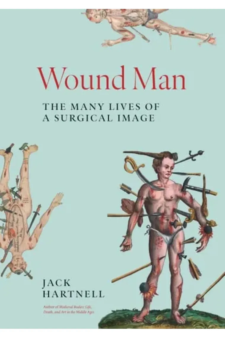 Wound Man The Many Lives of a Surgical Image (Inglés)