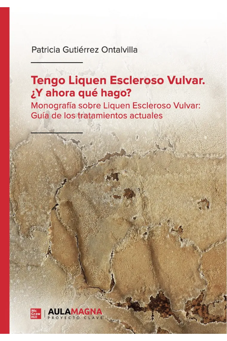 Tengo Liquen Escleroso Vulvar. Y ahora qué hago