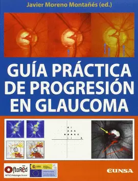 GUÍA PRÁCTICA DE PROGRESIÓN EN GLAUCOMA